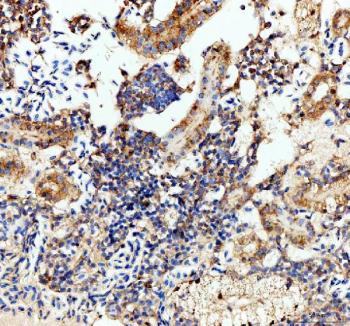 Zebrafish Luteinizing hormone beta / Lhb Antibody Kidney IHC. Immunohistochemistry staining of zebrafish Luteinizing hormone beta protein using Zebrafish Luteinizing hormone beta antibody, HRP-labeled secondary and DAB substrate. Luteinizing hormone beta was detected in a paraffin-embedded section of zebrafish kidney tissue. HIER: boil tissue sections in pH8 EDTA for 20 min and allow to cool before testing.