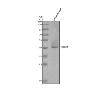 Zebrafish Tgfb1 Antibody Head Tissue WB. Western blot analysis of Tgfb1 protein using Zebrafish Tgfb1 antibody and zebrafish head tissue lysates. Predicted molecular weight ~43 kDa.