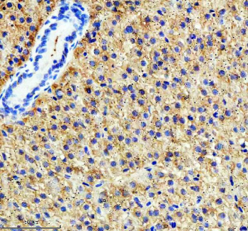 Zebrafish Tgfb1 Antibody Liver Tissue IHC. Immunohistochemistry staining of zebrafish Tgfb1 protein using Zebrafish Tgfb1 antibody, HRP-labeled secondary and DAB substrate. Tgfb1 was detected in a paraffin-embedded section of zebrafish liver tissue. HIER: boil tissue sections in pH8 EDTA for 20 min and allow to cool before testing.
