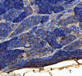 Zebrafish Tgfb1 Antibody Testis Tissue IHC. Immunohistochemistry staining of zebrafish Tgfb1 protein using Zebrafish Tgfb1 antibody, HRP-labeled secondary and DAB substrate. Tgfb1 was detected in a paraffin-embedded section of zebrafish testis tissue. HIER: boil tissue sections in pH8 EDTA for 20 min and allow to cool before testing.