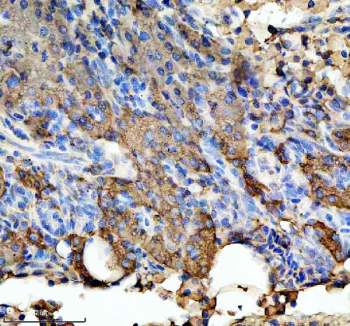 Zebrafish Hspa5 Antibody Liver Tissue IHC. Immunohistochemistry staining of FFPE zebrafish pancreas tissue with Hspa5 antibody, HRP-labeled secondary and DAB substrate. HIER: boil tissue sections in pH8 EDTA for 20 min and allow to cool before testing.