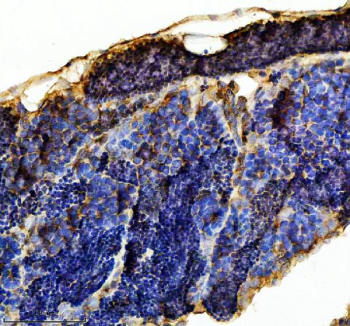 Zebrafish Hspa5 Antibody Testis Tissue IHC. Immunohistochemistry staining of FFPE zebrafish testis tissue with Hspa5 antibody, HRP-labeled secondary and DAB substrate. HIER: boil tissue sections in pH8 EDTA for 20 min and allow to cool before testing.