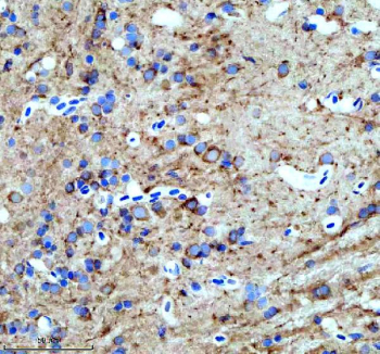 Zebrafish Hspa5 Antibody Brain Tissue IHC. Immunohistochemistry staining of FFPE zebrafish brain tissue with Hspa5 antibody, HRP-labeled secondary and DAB substrate. HIER: boil tissue sections in pH8 EDTA for 20 min and allow to cool before testing.