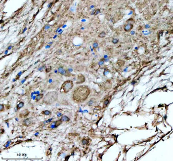 Zebrafish Hspa5 Antibody Spinal Cord Tissue IHC. Immunohistochemistry staining of FFPE zebrafish spinal cord tissue with Hspa5 antibody, HRP-labeled secondary and DAB substrate. HIER: boil tissue sections in pH8 EDTA for 20 min and allow to cool before testing.