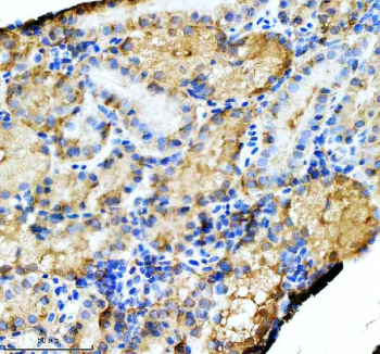 Zebrafish Hspa5 Antibody Kidney Tissue IHC. Immunohistochemistry staining of FFPE zebrafish kidney tissue with Hspa5 antibody, HRP-labeled secondary and DAB substrate. HIER: boil tissue sections in pH8 EDTA for 20 min and allow to cool before testing.