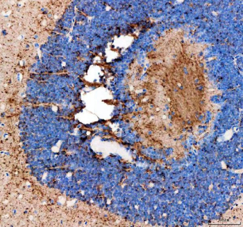 Zebrafish Fshb Antibody Eye Tissue IHC. Immunohistochemistry staining of FFPE zebrafish eye tissue with Zebrafish Fshb antibody, HRP-labeled secondary and DAB substrate. HIER: boil tissue sections in pH8 EDTA for 20 min and allow to cool before testing.