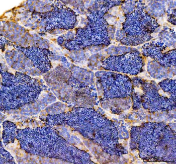 Zebrafish Fshb Antibody Testis Tissue IHC. Immunohistochemistry staining of FFPE zebrafish testis tissue with Zebrafish Fshb antibody, HRP-labeled secondary and DAB substrate. HIER: boil tissue sections in pH8 EDTA for 20 min and allow to cool before testing.