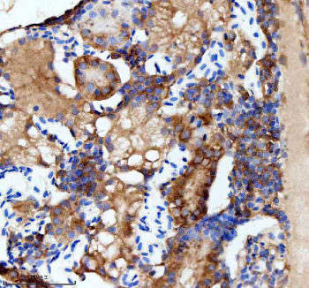 Zebrafish Flt1 / Vegfr1 Antibody Kidney Tissue IHC. Immunohistochemistry staining of zebrafish Flt1 protein using Zebrafish Flt1 antibody, HRP-labeled secondary and DAB substrate. Flt1 was detected in a paraffin-embedded section of zebrafish kidney tissue. HIER: boil tissue sections in pH8 EDTA for 20 min and allow to cool before testing.