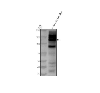 Zebrafish Flt1 / Vegfr1 Antibody Whole Tissue WB. Western blot analysis of Flt1 protein using Zebrafish Flt1 antibody and whole male zebrafish tissue lysates. Predicted molecular weight ~142 kDa.