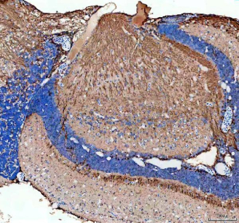 Zebrafish Flt1 / Vegfr1 Antibody Brain Tissue IHC. Immunohistochemistry staining of zebrafish Flt1 protein using Zebrafish Flt1 antibody, HRP-labeled secondary and DAB substrate. Flt1 was detected in a paraffin-embedded section of zebrafish brain tissue. HIER: boil tissue sections in pH8 EDTA for 20 min and allow to cool before testing.