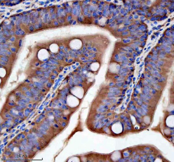 Zebrafish Flt1 / Vegfr1 Antibody Colon Tissue IHC. Immunohistochemistry staining of zebrafish Flt1 protein using Zebrafish Flt1 antibody, HRP-labeled secondary and DAB substrate. Flt1 was detected in a paraffin-embedded section of zebrafish colon tissue. HIER: boil tissue sections in pH8 EDTA for 20 min and allow to cool before testing.