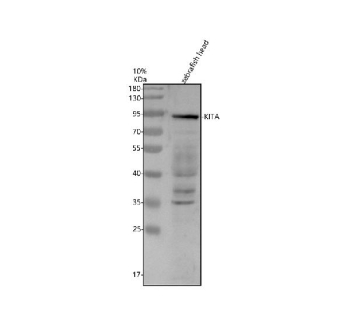 Zebrafish Kita / Kit Antibody Head Tissue WB. Western blot analysis of Kita protein using Zebrafish Kita antibody and zebrafish head tissue lysates. Predicted molecular weight ~109 kDa.