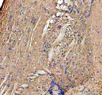 Zebrafish Kita / Kit Antibody Brain Tissue IHC. Immunohistochemistry staining of zebrafish Kita protein using Zebrafish Kita antibody, HRP-labeled secondary and DAB substrate. Kita was detected in a paraffin-embedded section of zebrafish brain tissue. HIER: boil tissue sections in pH8 EDTA for 20 min and allow to cool before testing.