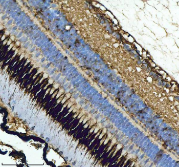 Zebrafish Gnrh2 Antibody Eye Tissue IHC. Immunohistochemistry staining of zebrafish Gnrh2 protein using Zebrafish Gnrh2 antibody, HRP-labeled secondary and DAB substrate. Gnrh2 was detected in a paraffin-embedded section of zebrafish eye tissue. HIER: boil tissue sections in pH8 EDTA for 20 min and allow to cool before testing.