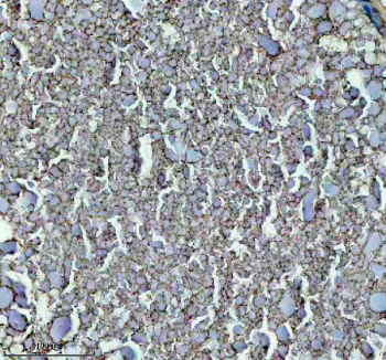 Zebrafish Gnrh2 Antibody Ovary Tissue IHC. Immunohistochemistry staining of zebrafish Gnrh2 protein using Zebrafish Gnrh2 antibody, HRP-labeled secondary and DAB substrate. Gnrh2 was detected in a paraffin-embedded section of zebrafish ovary tissue. HIER: boil tissue sections in pH8 EDTA for 20 min and allow to cool before testing.