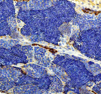 Zebrafish Lhcgr Antibody Testis Tissue IHC. Immunohistochemistry staining of zebrafish Lhcgr protein using Zebrafish Lhcgr antibody, HRP-labeled secondary and DAB substrate. Lhcgr was detected in a paraffin-embedded section of zebrafish testis tissue. HIER: boil tissue sections in pH8 EDTA for 20 min and allow to cool before testing.
