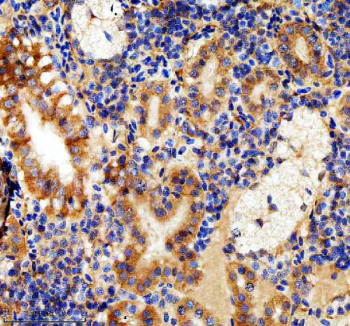 Zebrafish Lhcgr Antibody Liver Tissue IHC. Immunohistochemistry staining of zebrafish Lhcgr protein using Zebrafish Lhcgr antibody, HRP-labeled secondary and DAB substrate. Lhcgr was detected in a paraffin-embedded section of zebrafish liver tissue. HIER: boil tissue sections in pH8 EDTA for 20 min and allow to cool before testing.