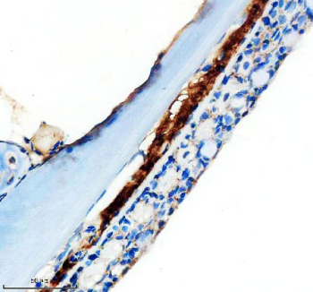 Zebrafish Mmp13a Antibody Skin Tissue IHC. Immunohistochemistry staining of FFPE zebrafish skin tissue with Zebrafish Mmp13a antibody, HRP-labeled secondary and DAB substrate. HIER: boil tissue sections in pH8 EDTA for 20 min and allow to cool before testing.