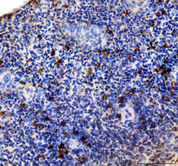 Zebrafish Mmp13a Antibody Spleen Tissue IHC. Immunohistochemistry staining of FFPE zebrafish spleen tissue with Zebrafish Mmp13a antibody, HRP-labeled secondary and DAB substrate. HIER: boil tissue sections in pH8 EDTA for 20 min and allow to cool before testing.