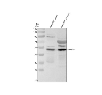 Zebrafish Tfap2a Antibody Head and Embryo Tissue WB. Western blot analysis of Tfap2a protein using Zebrafish Tfap2a antibody and 1) zebrafish head tissue lysates and 2) zebrafish embryo tissue lysates. Predicted molecular weight ~50 kDa.