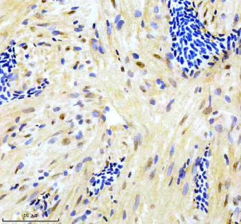 Zebrafish Gata6 Antibody Heart Tissue IHC. Immunohistochemistry staining of zebrafish Gata6 protein using Zebrafish Gata6 antibody, HRP-labeled secondary and DAB substrate. Gata6 was detected in a paraffin-embedded section of zebrafish heart tissue. HIER: boil tissue sections in pH8 EDTA for 20 min and allow to cool before testing.