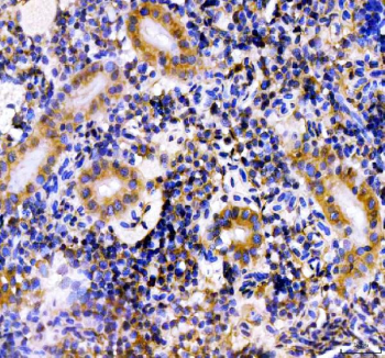 Zebrafish Hsd3b1 Antibody Kidney Tissue IHC. Immunohistochemistry staining of FFPE zebrafish kidney tissue with Zebrafish Hsd3b1 antibody, HRP-labeled secondary and DAB substrate. HIER: boil tissue sections in pH8 EDTA for 20 min and allow to cool before testing.