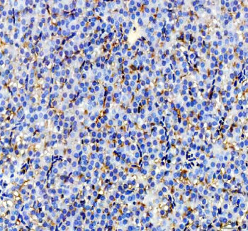 Zebrafish Igf2a Antibody Liver Tissue IHC. Immunohistochemistry staining of zebrafish Igf2a protein using Zebrafish Igf2a antibody, HRP-labeled secondary and DAB substrate. Insulin-like growth factor 2 was detected in a paraffin-embedded section of zebrafish liver tissue. HIER: boil tissue sections in pH8 EDTA for 20 min and allow to cool before testing.