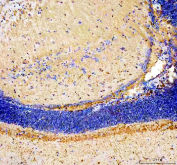 Zebrafish Igf2a Antibody Brain Tissue IHC. Immunohistochemistry staining of zebrafish Igf2a protein using Zebrafish Igf2a antibody, HRP-labeled secondary and DAB substrate. Insulin-like growth factor 2 was detected in a paraffin-embedded section of zebrafish brain tissue. HIER: boil tissue sections in pH8 EDTA for 20 min and allow to cool before testing.