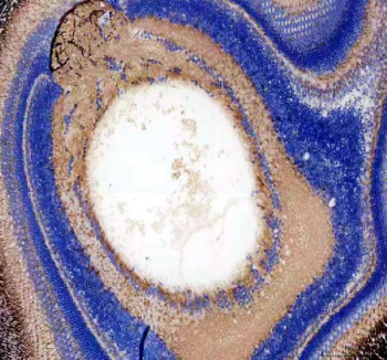 Zebrafish Igf2a Antibody Eye Tissue IHC. Immunohistochemistry staining of zebrafish Igf2a protein using Zebrafish Igf2a antibody, HRP-labeled secondary and DAB substrate. Insulin-like growth factor 2 was detected in a paraffin-embedded section of zebrafish eye tissue. HIER: boil tissue sections in pH8 EDTA for 20 min and allow to cool before testing.