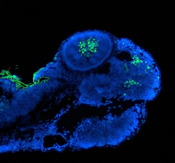 Zebrafish Pax6 Antibody Embryo Tissue IF. Immunofluorescence analysis of zebrafish embryo tissue. Immunofluorescent staining of FFPE zebrafish embryo using Zebrafish Pax6 antibody (green) shows nuclear localization of Pax6-positive cells within developing embryonic structures, consistent with the role of Paired Box Protein Pax-6 in early vertebrate eye and neural development. Nuclei are counterstained with DAPI (blue). HIER: steam sections in pH8 EDTA buffer for 20 minutes prior to staining.