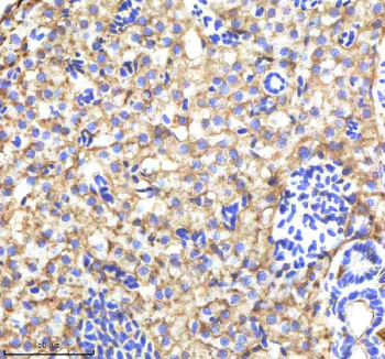 Zebrafish Alcama Antibody Liver Tissue IHC. Immunohistochemistry staining of FFPE zebrafish liver tissue with Zebrafish Alcama antibody, HRP-labeled secondary and DAB substrate. HIER: boil tissue sections in pH8 EDTA for 20 min and allow to cool before testing.