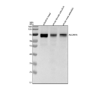 Zebrafish Alcama Antibody Tissue WB. Western blot analysis of Alcama protein using Zebrafish Alcama antibody and 1) zebrafish head, 2) whole female zebrafish and 3) whole male zebrafish lysate. Predicted molecular weight ~61 kDa but may be observed at higher molecular weights due to glycosylation.