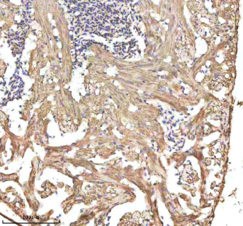 Zebrafish Alcama Antibody Heart Tissue IHC. Immunohistochemistry staining of FFPE zebrafish heart tissue with Zebrafish Alcama antibody, HRP-labeled secondary and DAB substrate. HIER: boil tissue sections in pH8 EDTA for 20 min and allow to cool before testing.