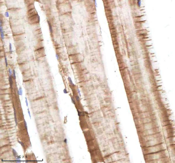 Zebrafish Alcama Antibody Muscle Tissue IHC. Immunohistochemistry staining of FFPE zebrafish muscle tissue with Zebrafish Alcama antibody, HRP-labeled secondary and DAB substrate. HIER: boil tissue sections in pH8 EDTA for 20 min and allow to cool before testing.