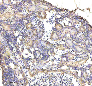Zebrafish Alcama Antibody Kidney Tissue IHC. Immunohistochemistry staining of FFPE zebrafish kidney tissue with Zebrafish Alcama antibody, HRP-labeled secondary and DAB substrate. HIER: boil tissue sections in pH8 EDTA for 20 min and allow to cool before testing.