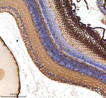 Zebrafish Atoh7 Antibody Eye Tissue IHC. Immunohistochemistry staining of zebrafish Atoh7 protein using Zebrafish Atoh7 antibody, HRP-labeled secondary and DAB substrate. Atoh7 was detected in a paraffin-embedded section of zebrafish eye tissue. HIER: boil tissue sections in pH8 EDTA for 20 min and allow to cool before testing.