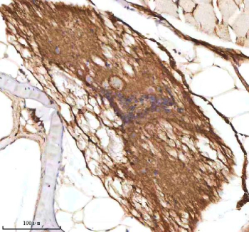 Zebrafish Axin2 Antibody Spinal Cord Tissue IHC. Immunohistochemistry staining of zebrafish Axin2 protein using Zebrafish Axin2 antibody, HRP-labeled secondary and DAB substrate. Axin2 was detected in a paraffin-embedded section of zebrafish spinal cord tissue. HIER: boil tissue sections in pH8 EDTA for 20 min and allow to cool before testing.