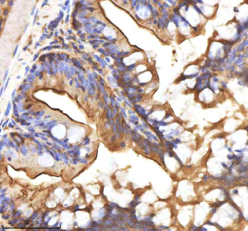 Zebrafish Axin2 Antibody Colon Tissue IHC. Immunohistochemistry staining of zebrafish Axin2 protein using Zebrafish Axin2 antibody, HRP-labeled secondary and DAB substrate. Axin2 was detected in a paraffin-embedded section of zebrafish colon tissue. HIER: boil tissue sections in pH8 EDTA for 20 min and allow to cool before testing.