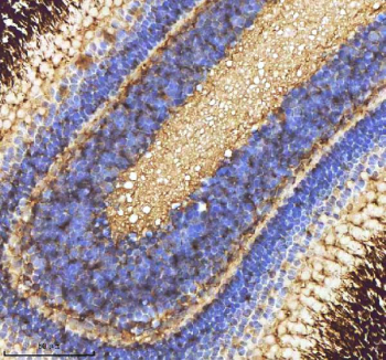 Zebrafish Caspase 9 Antibody Eye Tissue IHC. Immunohistochemistry staining of FFPE zebrafish eye tissue with Zebrafish Caspase 9 antibody, HRP-labeled secondary and DAB substrate. HIER: boil tissue sections in pH8 EDTA for 20 min and allow to cool before testing.