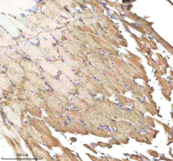 Zebrafish Caspase 9 Antibody Muscle Tissue IHC. Immunohistochemistry staining of FFPE zebrafish muscle tissue with Zebrafish Caspase 9 antibody, HRP-labeled secondary and DAB substrate. HIER: boil tissue sections in pH8 EDTA for 20 min and allow to cool before testing.
