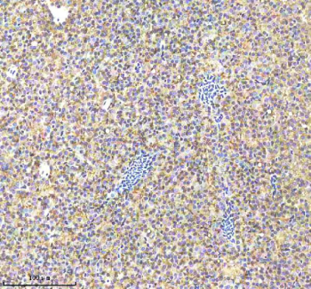 Zebrafish Caspase 9 Antibody Liver Tissue IHC. Immunohistochemistry staining of FFPE zebrafish liver tissue with Zebrafish Caspase 9 antibody, HRP-labeled secondary and DAB substrate. HIER: boil tissue sections in pH8 EDTA for 20 min and allow to cool before testing.