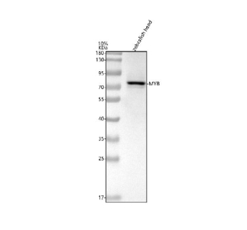 Zebrafish c-Myb Antibody Head Tissue WB. Western blot analysis of c-Myb protein using Zebrafish c-Myb antibody and zebrafish head tissue lysates. Predicted molecular weight ~67 kDa and ~72 kDa (two isoforms).