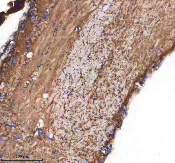 Zebrafish Cxcl12 Antibody Spinal Cord Tissue IHC. Immunohistochemistry staining of zebrafish Cxcl12 protein using Zebrafish Cxcl12 antibody, HRP-labeled secondary and DAB substrate. Cxcl12 was detected in a paraffin-embedded section of zebrafish spinal cord tissue. HIER: boil tissue sections in pH8 EDTA for 20 min and allow to cool before testing.
