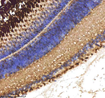 Zebrafish Cxcl8a / Il-8 Antibody Eye Tissue IHC. Immunohistochemistry staining of zebrafish Cxcl8a protein using Zebrafish Cxcl8a antibody, HRP-labeled secondary and DAB substrate. Cxcl8a was detected in a paraffin-embedded section of zebrafish eye tissue. HIER: boil tissue sections in pH8 EDTA for 20 min and allow to cool before testing.