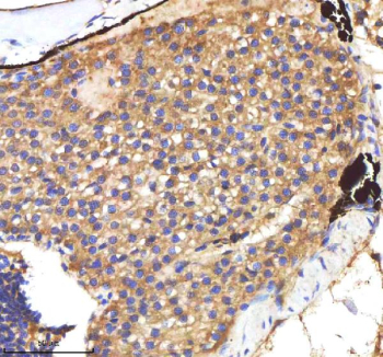 Zebrafish Cxcl8a / Il-8 Antibody Liver Tissue IHC. Immunohistochemistry staining of zebrafish Cxcl8a protein using Zebrafish Cxcl8a antibody, HRP-labeled secondary and DAB substrate. Cxcl8a was detected in a paraffin-embedded section of zebrafish liver tissue. HIER: boil tissue sections in pH8 EDTA for 20 min and allow to cool before testing.