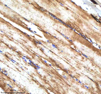 Zebrafish Cxcl8a / Il-8 Antibody Muscle Tissue IHC. Immunohistochemistry staining of zebrafish Cxcl8a protein using Zebrafish Cxcl8a antibody, HRP-labeled secondary and DAB substrate. Cxcl8a was detected in a paraffin-embedded section of zebrafish muscle tissue. HIER: boil tissue sections in pH8 EDTA for 20 min and allow to cool before testing.