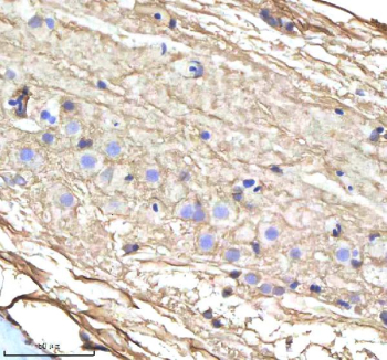 Zebrafish Cyp17a1 Antibody Spinal Cord Tissue IHC. Immunohistochemistry staining of zebrafish Cyp17a1 protein using Zebrafish Cyp17a1 antibody, HRP-labeled secondary and DAB substrate. Cyp17a1 was detected in a paraffin-embedded section of zebrafish spinal cord tissue. HIER: boil tissue sections in pH8 EDTA for 20 min and allow to cool before testing.