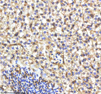 Zebrafish Cyp17a1 Antibody Liver Tissue IHC. Immunohistochemistry staining of zebrafish Cyp17a1 protein using Zebrafish Cyp17a1 antibody, HRP-labeled secondary and DAB substrate. Cyp17a1 was detected in a paraffin-embedded section of zebrafish liver tissue. HIER: boil tissue sections in pH8 EDTA for 20 min and allow to cool before testing.