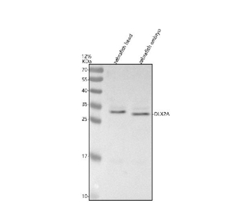 Zebrafish Dlx2a / Dlx2 Antibody Tissue WB. Western blot analysis of Dlx2a protein using Zebrafish Dlx2a antibody and 1) zebrafish head tissue lysates and 2) zebrafish embryo tissue lysates. Predicted molecular weight ~30 kDa.