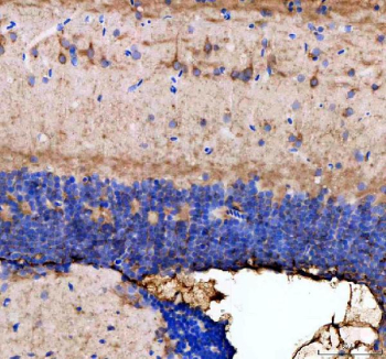 Zebrafish Dnm1 Antibody Brain Tissue IHC. Immunohistochemistry staining of FFPE zebrafish brain tissue with Zebrafish Dnm1 / Dynamin antibody, HRP-labeled secondary and DAB substrate. HIER: boil tissue sections in pH8 EDTA for 20 min and allow to cool before testing.